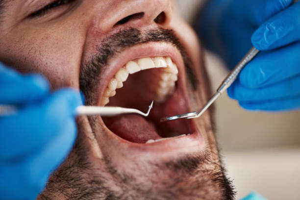 Best Emergency Tooth Extraction  in Kodi, AK